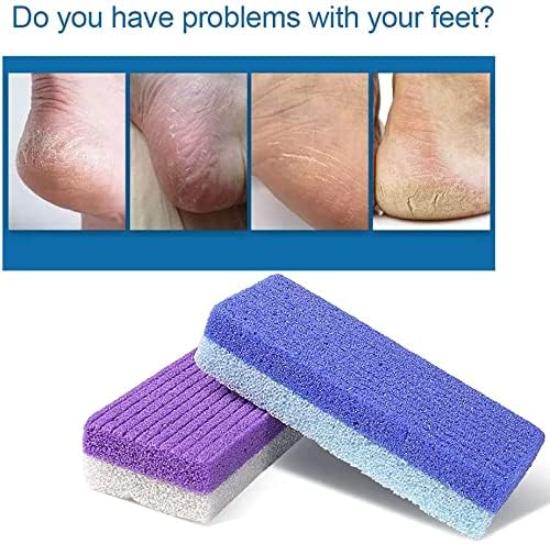 Foot Pumice Stone Exfoliating Pumice Stone Foot Scrubber Sponge Hard Skin Removal Foot Care for Callus Remover, Feet Smooths Skin - Blue